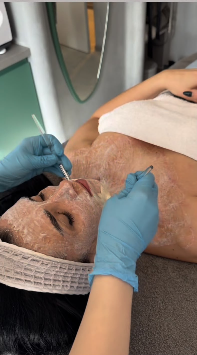 Foto nga burimi: Periudha ideale për peeling dhe trajtime intensive të fytyrës, Beautytime zgjedhja perfekte!